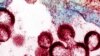 Spanish HIV Vaccine Shows 90 Percent Success in Early Trial