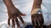 Les mains d'un patient souffrant d'éruptions cutanées causées par le virus mpox. Kinshasa, 30 août 2024. Reuters / Justin Makangara